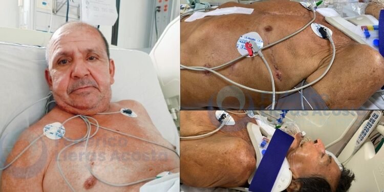 Servicio social, dos hombres están abandonados en el Hospital Federico Lleras Acosta