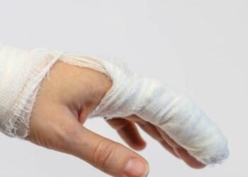 Hubo una reducción del 37% de personas quemadas por pólvora en Ibagué