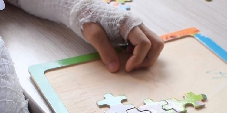 Menor de edad resultó quemado con una mecha que recogió del suelo y le estalló en sus manos