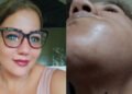 Jovencita denuncia falta de atención para mamá con cáncer pese a fallo de tutela en Ibagué