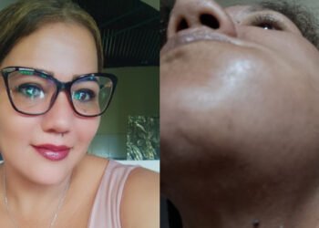 Jovencita denuncia falta de atención para mamá con cáncer pese a fallo de tutela en Ibagué