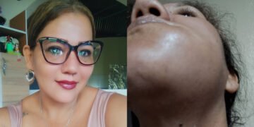 Jovencita denuncia falta de atención para mamá con cáncer pese a fallo de tutela en Ibagué