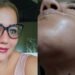 Jovencita denuncia falta de atención para mamá con cáncer pese a fallo de tutela en Ibagué