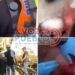 Corralejas y cabalgatas dejan una persona luchando por su vida, caballistas heridos y un caballo al borde de la muerte en El Espinal