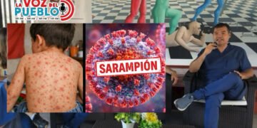 Por viajes del mundial se podrían incrementar los casos de Sarampión en Colombia