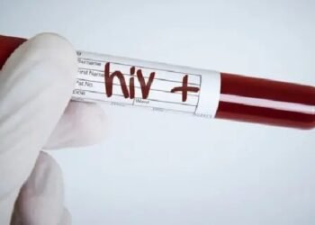 Ibagué registra reducción del 41 % en los casos confirmados de VIH durante el primer semestre