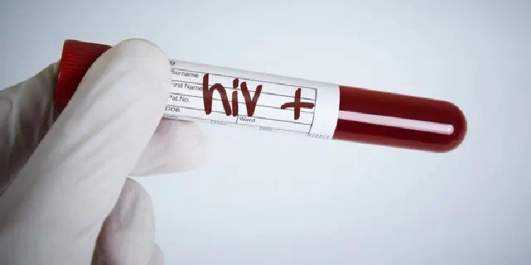 Ibagué registra reducción del 41 % en los casos confirmados de VIH durante el primer semestre