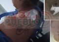 Dos mujeres heridas y una perrita muerta en ataque de un sujeto en el barrio El Bosque