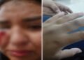 Joven denunció que su expareja la habría golpeado con un bate dentro de una buseta en Ibagué