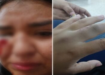 Joven denunció que su expareja la habría golpeado con un bate dentro de una buseta en Ibagué