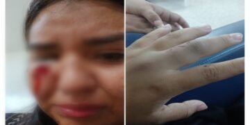 Joven denunció que su expareja la habría golpeado con un bate dentro de una buseta en Ibagué