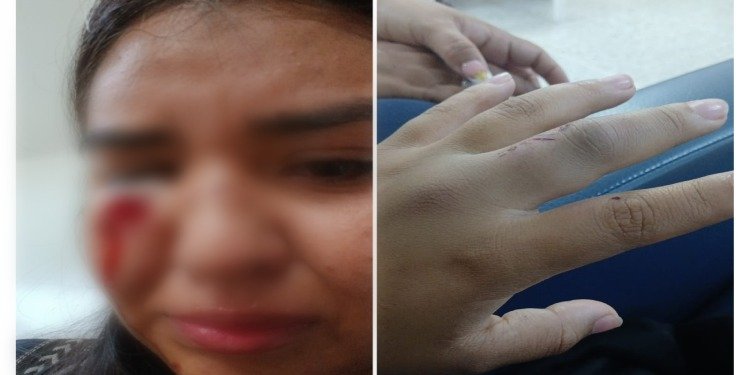 Joven denunció que su expareja la habría golpeado con un bate dentro de una buseta en Ibagué
