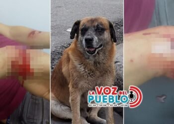 ¡Pudo terminar en tragedia! Perro callejero atacó a un hombre en Cajamarca y lo dejó hospitalizado en Ibagué