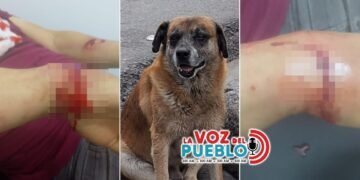 ¡Pudo terminar en tragedia! Perro callejero atacó a un hombre en Cajamarca y lo dejó hospitalizado en Ibagué