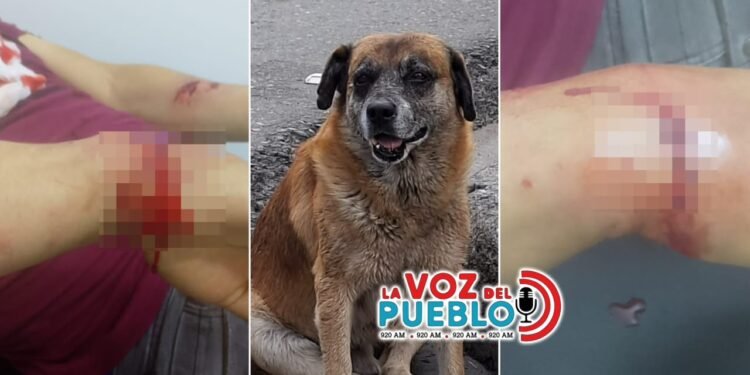 ¡Pudo terminar en tragedia! Perro callejero atacó a un hombre en Cajamarca y lo dejó hospitalizado en Ibagué